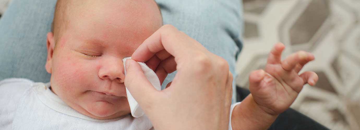 Causes Des Yeux Colles Et Larmoyants De Votre Bebe Lotus Causes Des Yeux Colles Et Larmoyants De Votre Bebe Lotus