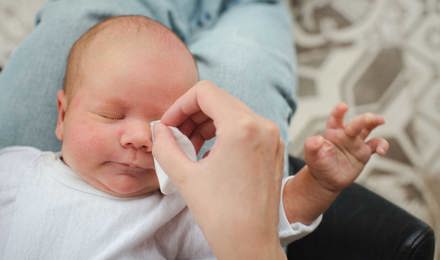 Des parents nettoient les yeux d'un bébé